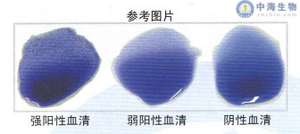 雞白痢雞傷寒多價(jià)染色平板凝集試驗抗原結果判定參考圖片